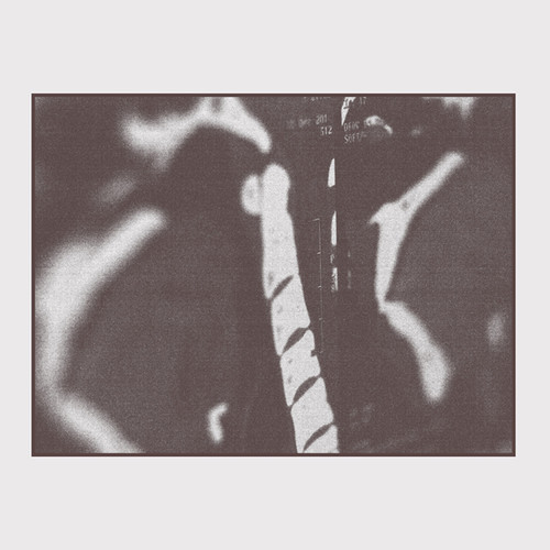 Mri